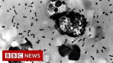 Ancient teeth reveal where Black Death began, researchers say - BBC News