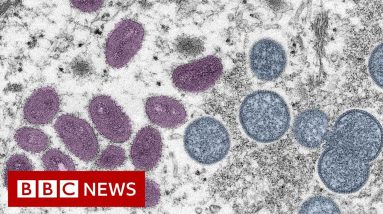 First monkeypox deaths reported outside Africa - BBC News