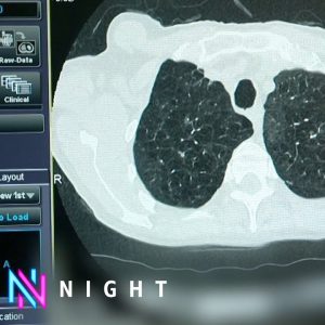 Why is England’s cancer crisis getting worse? - BBC Newsnight