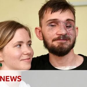 How Ukraine's war wounded repair their lives - BBC News