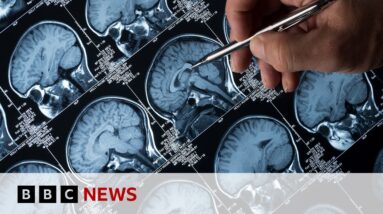 Using virtual reality to diagnose Alzheimer's disease | BBC News