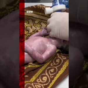 Baby saved from dead mother's womb after Israeli strike. #Shorts #Gaza #BBCNews