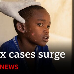 Mpox vaccinations are set to begin as cases surge | BBC News