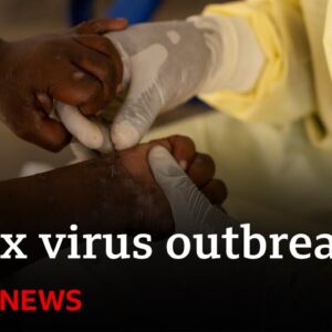 Sweden confirms first case of new mpox variant | BBC News