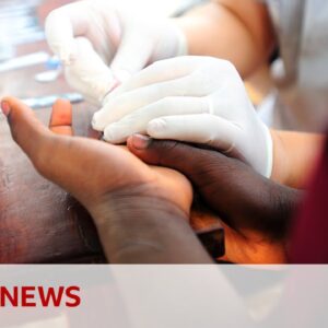 HIV patients at risk following USAID cuts | BBC News