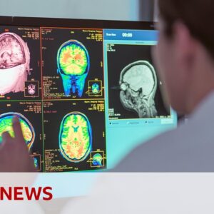 Adolescence lasts into 30s, new study shows | BBC News