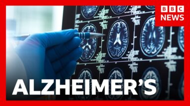 'Breakthrough' Alzheimer's drugs unlikely to benefit patients, report suggests | BBC News