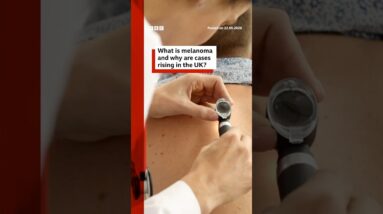 Melanoma skin cancer cases hit UK record high. #BBCNews