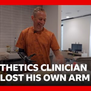 ‘I worked with prosthetic limbs, then I lost my arm’ | BBC News
