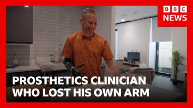 ‘I worked with prosthetic limbs, then I lost my arm’ | BBC News