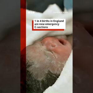 One in four births in England are now emergency caesareans, BBC analysis shows. #BBCNews