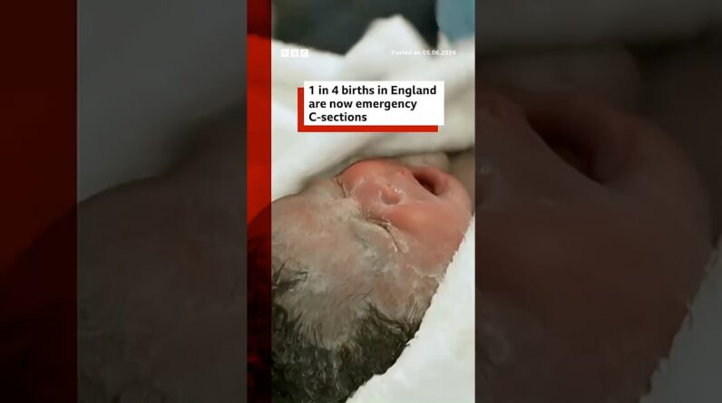 One in four births in England are now emergency caesareans, BBC analysis shows. #BBCNews