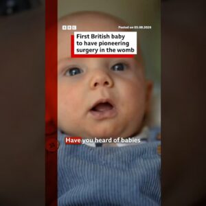 First British baby has life-changing surgery in womb. #BBCNews