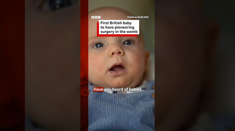 First British baby has life-changing surgery in womb. #BBCNews
