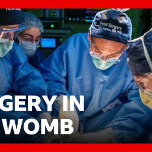 Pioneering womb surgery for 'miracle' baby with intestines outside its body | BBC News